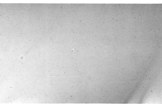 A black and white photo of a person's face